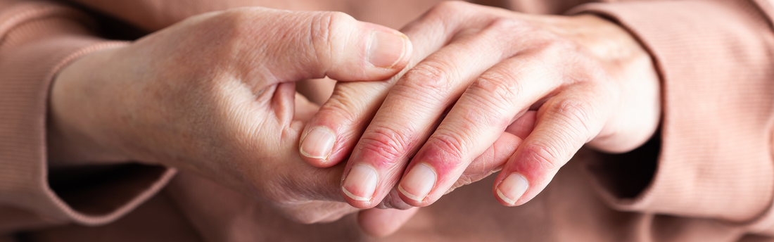 Spring Allergies and Disposable Gloves
