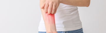 How Can You Tell if You're Allergic to Latex Gloves?